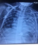 Héctor Pérez Perafán