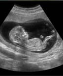 Francisco Martinez Curtis