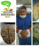 Hervey Fuentes de la Cruz