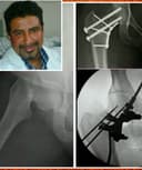 Dr. Walter Alcudia Hernández