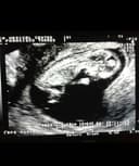 Francisco Román Torres Huerta