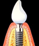 Alejandro Rodriguez del Rey